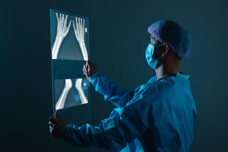 chụp x-quang khớp