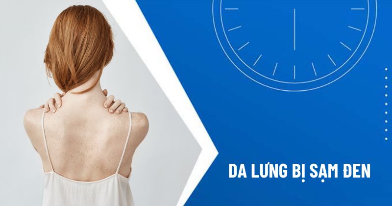 da lưng bị sạm đen