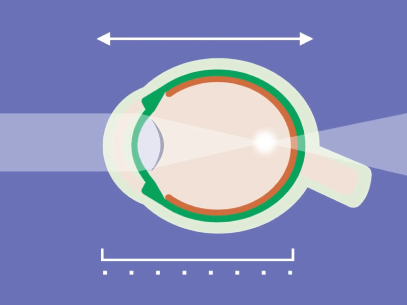 cấu trúc giải phẫu mắt