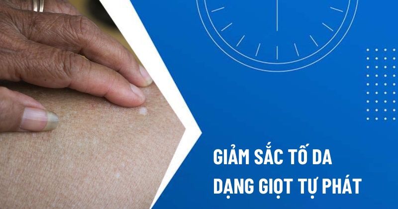 giảm sắc tố da dạng giọt tự phát