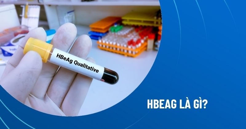 HBeAg