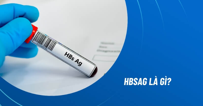 HBsAg