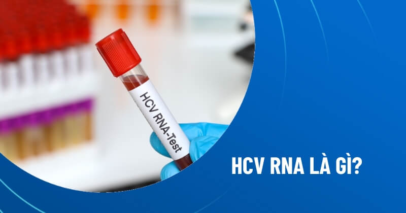 HCV RNA