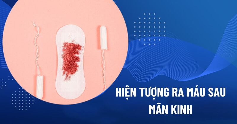 hiện tượng ra máu sau mãn kinh​