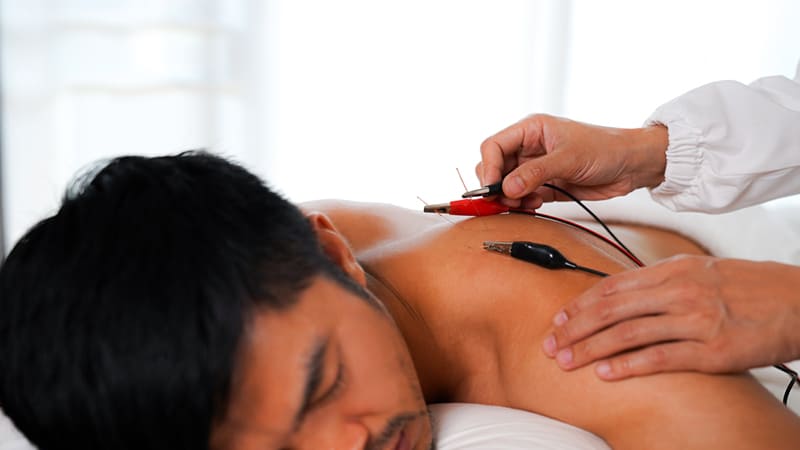 kỹ thuật điện châm