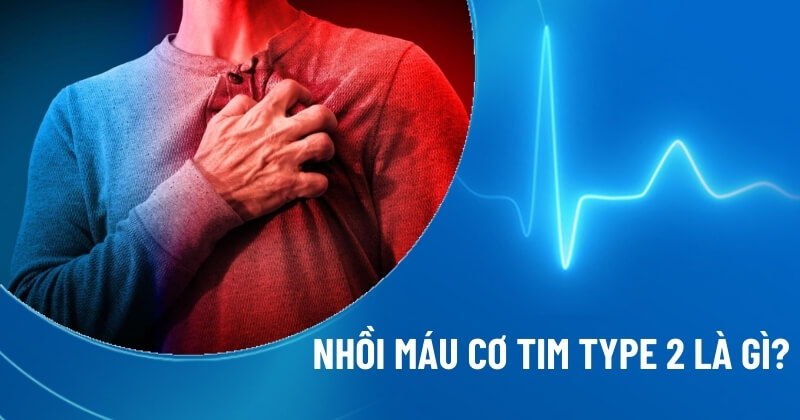 nhồi máu cơ tim type 2