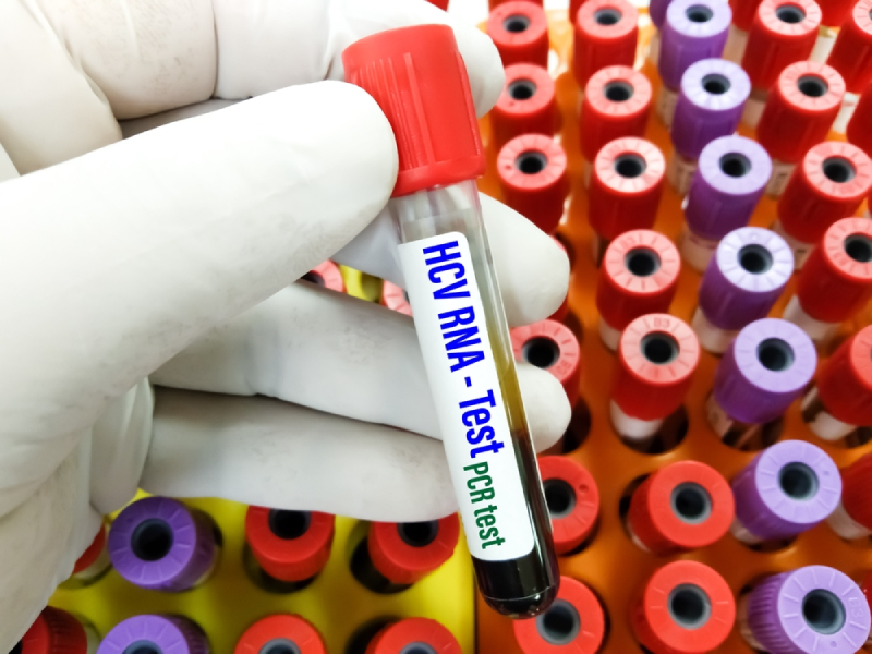 ống máu xét nghiệm hcv rna
