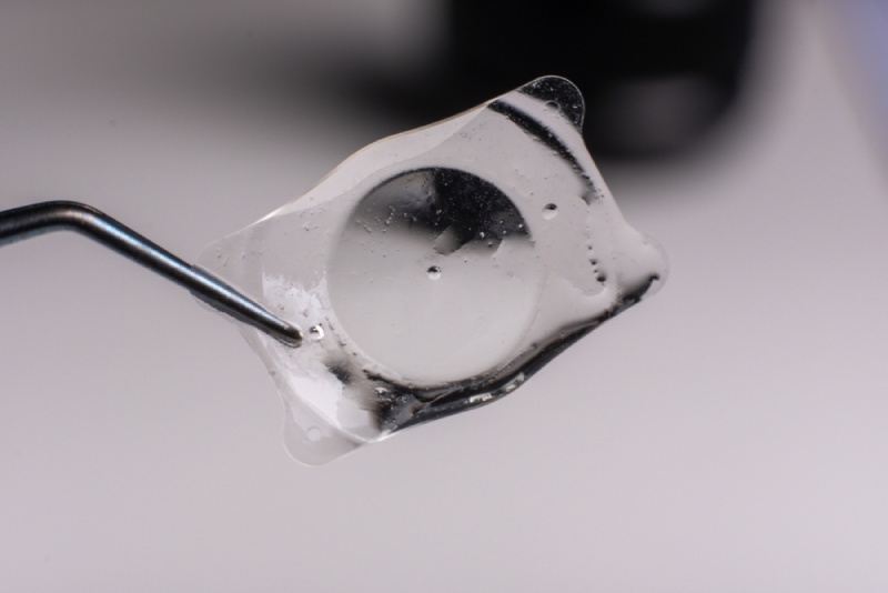 thấu kính nội nhãn ICL