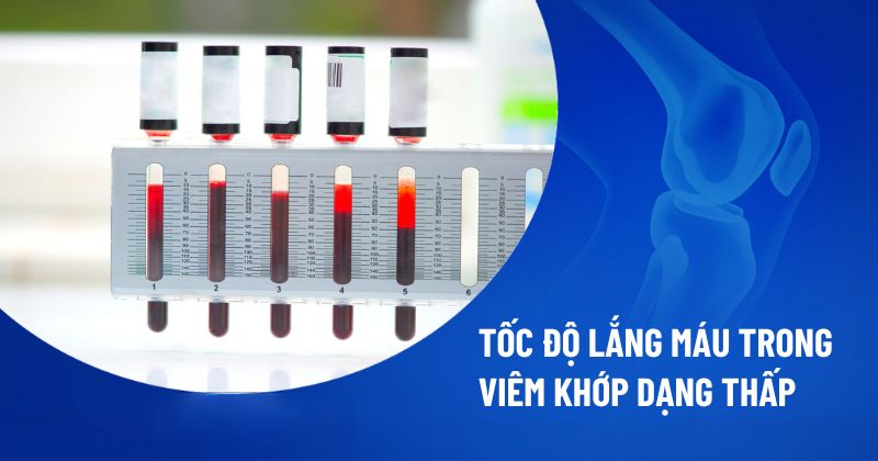 tốc độ lắng máu trong viêm khớp dạng thấp