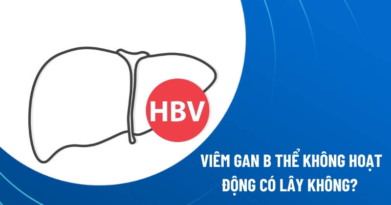viêm gan b thể không hoạt động có lây không