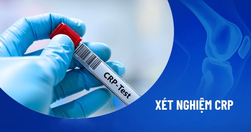 xét nghiệm crp
