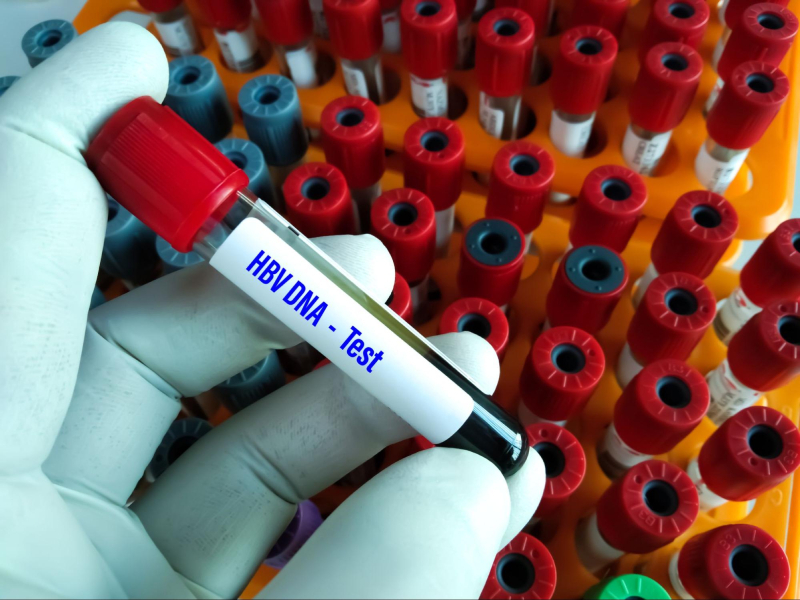 xét nghiệm định lượng hbv dna