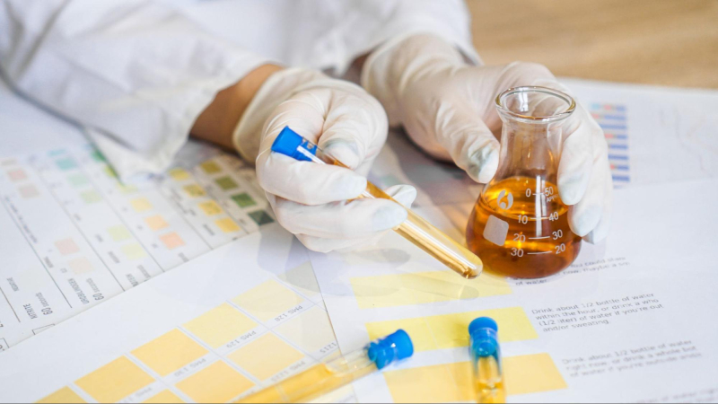 xét nghiệm nước tiểu