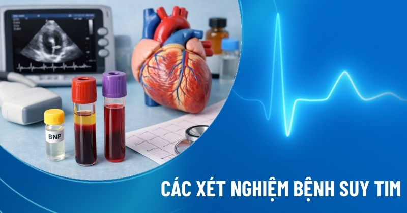 xét nghiệm suy tim