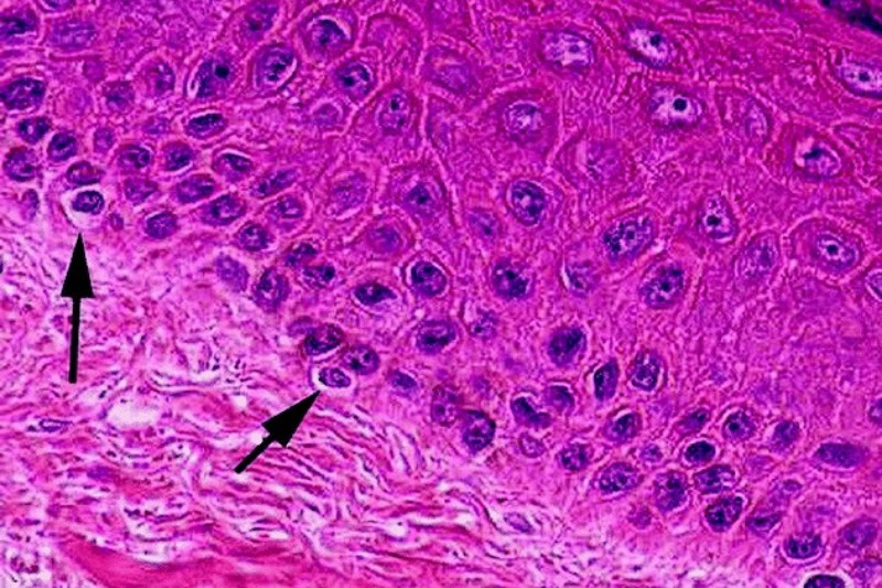 ảnh tế bào sắc tố melanocyte​ trên hiển vi