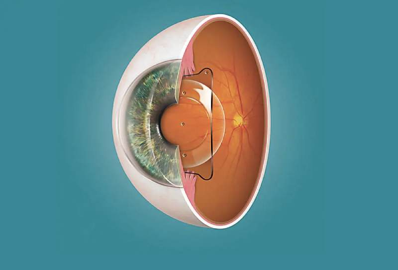 cấu trúc mắt