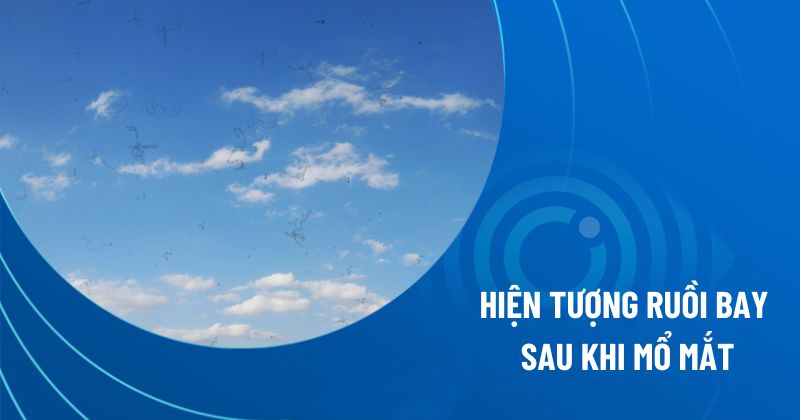 hiện tượng ruồi bay sau khi mổ mắt