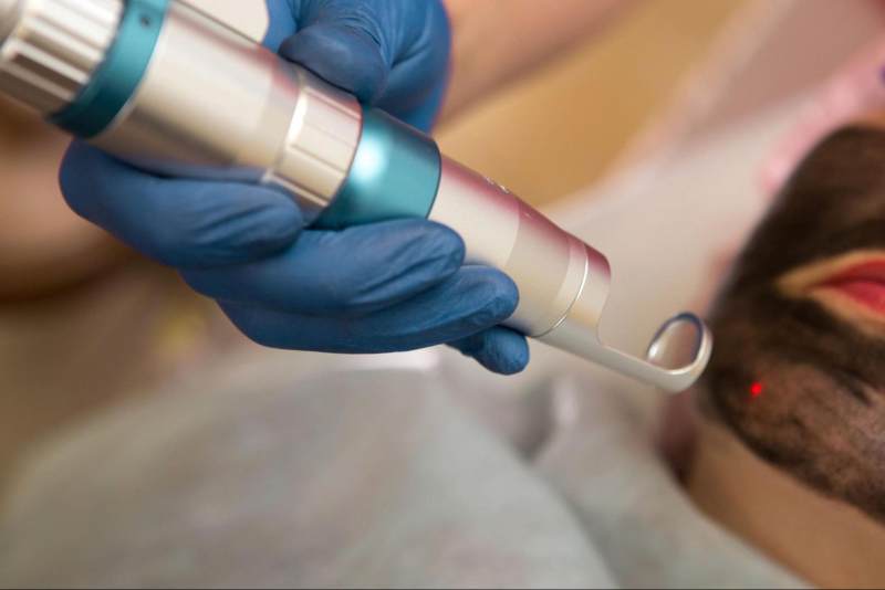 laser làm đẹp da