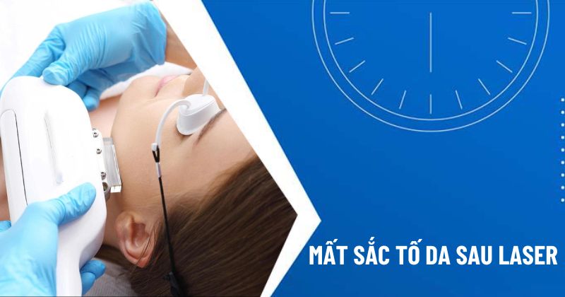 mất sắc tố da sau laser
