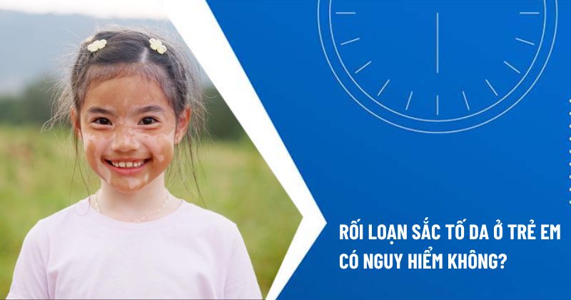 rối loạn sắc tố da ở trẻ em