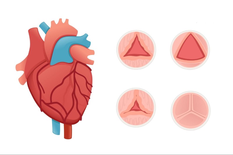 bệnh van tim gián đoạn gây suy tim