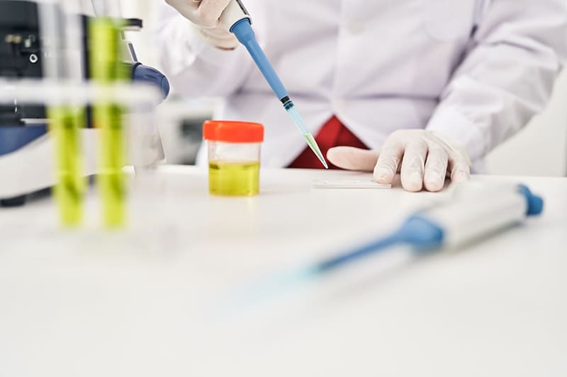 xét nghiệm nước tiểu