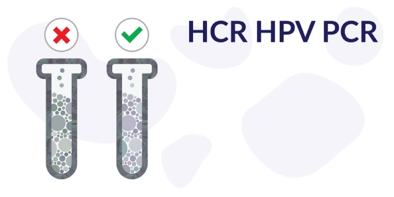 xét nghiệm pcr sùi mào gà