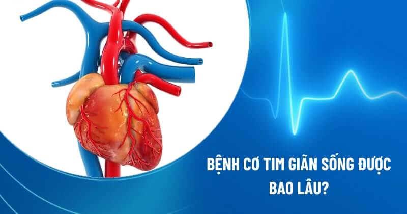 bệnh cơ tim giãn sống được bao lâu