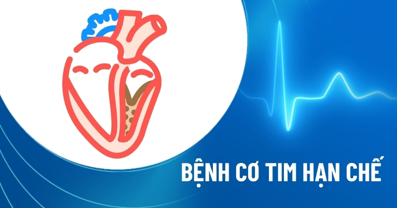 bệnh cơ tim hạn chế
