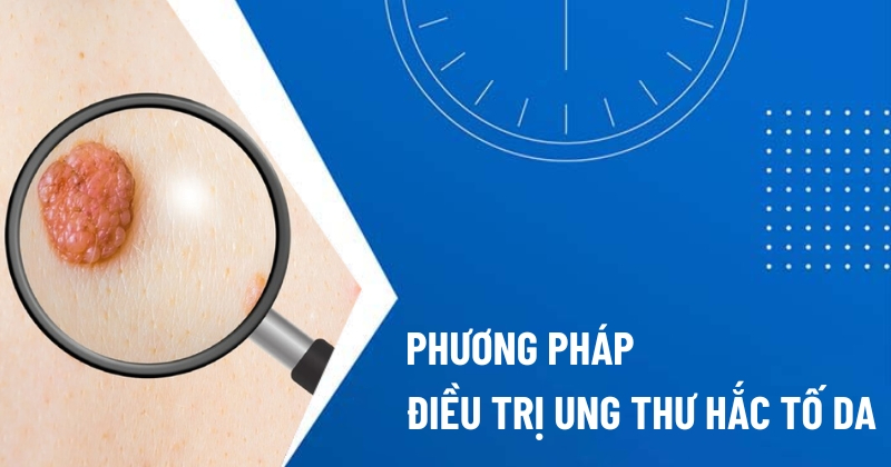 cách điều trị ung thư hắc tố da