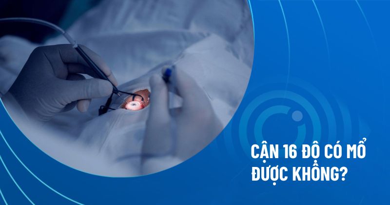 cận 16 độ có mổ được không