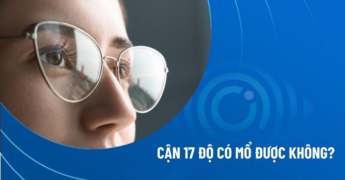 cận 17 độ có mổ được không