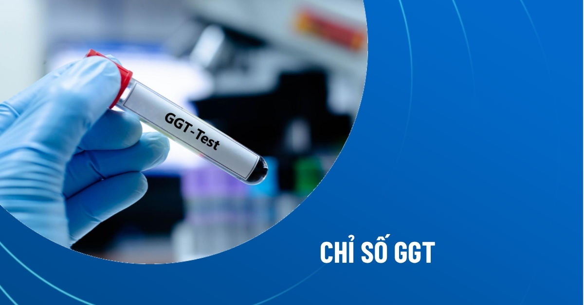 Chỉ số GGT