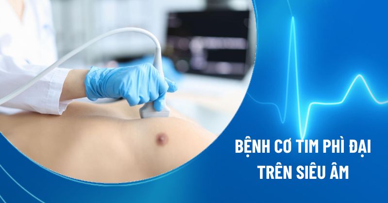 siêu âm bệnh cơ tim