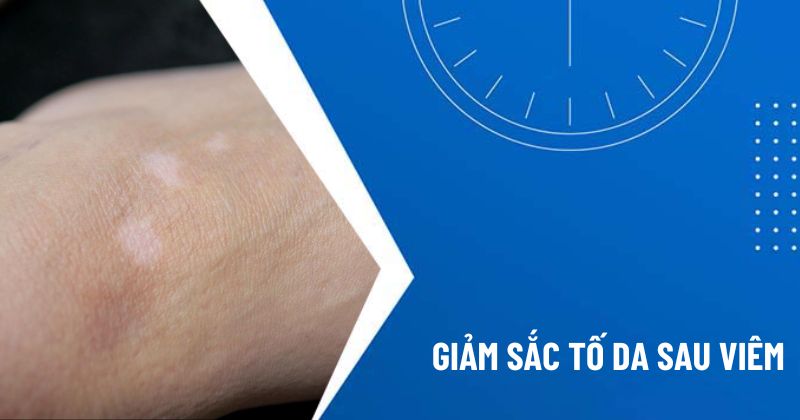 giảm sắc tố da sau viêm