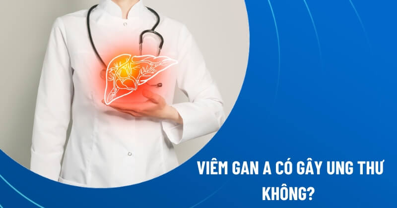 viêm gan a có gây ung thư không