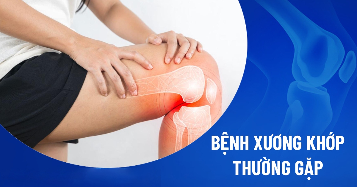 Bệnh xương khớp