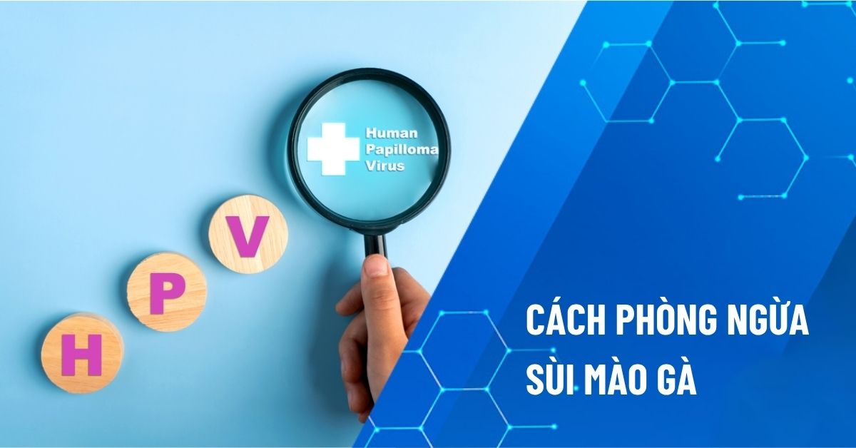 cách phòng ngừa sùi mào gà