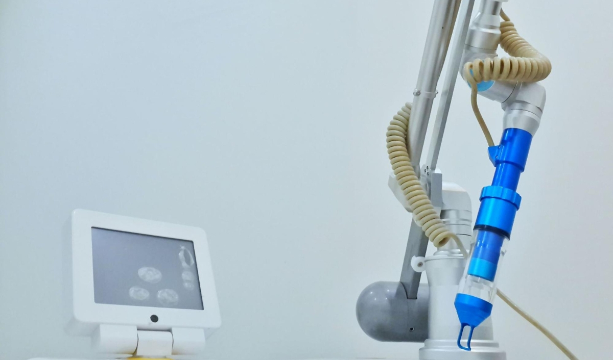 cải thiện u hắc tố bẩm sinh bằng laser