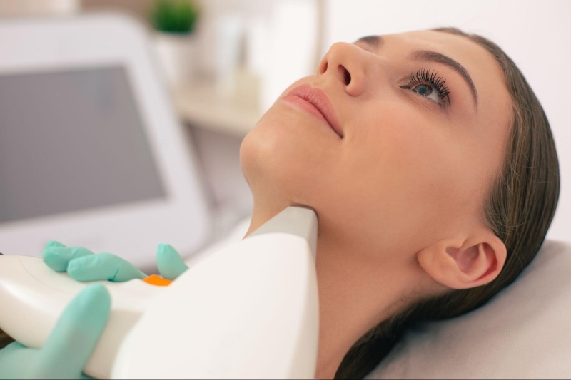 điều trị laser da dưới cằm sạm