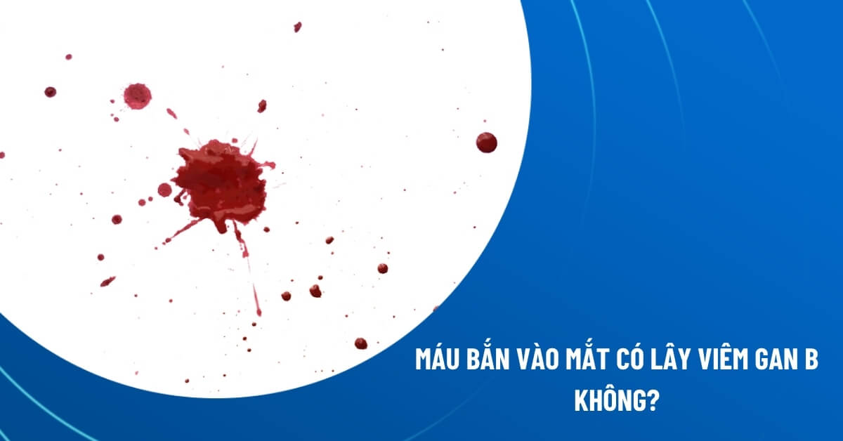 máu bắn vào mắt có lây viêm gan B không