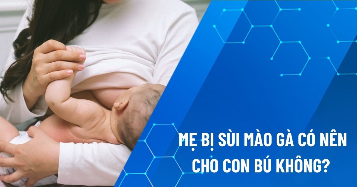 mẹ bị sùi mào gà có nên cho con bú không