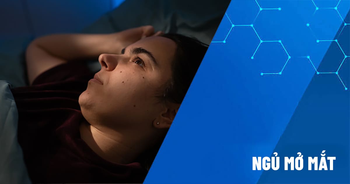 ngủ mở mắt
