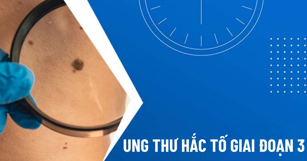 ung thư hắc tố giai đoạn 3