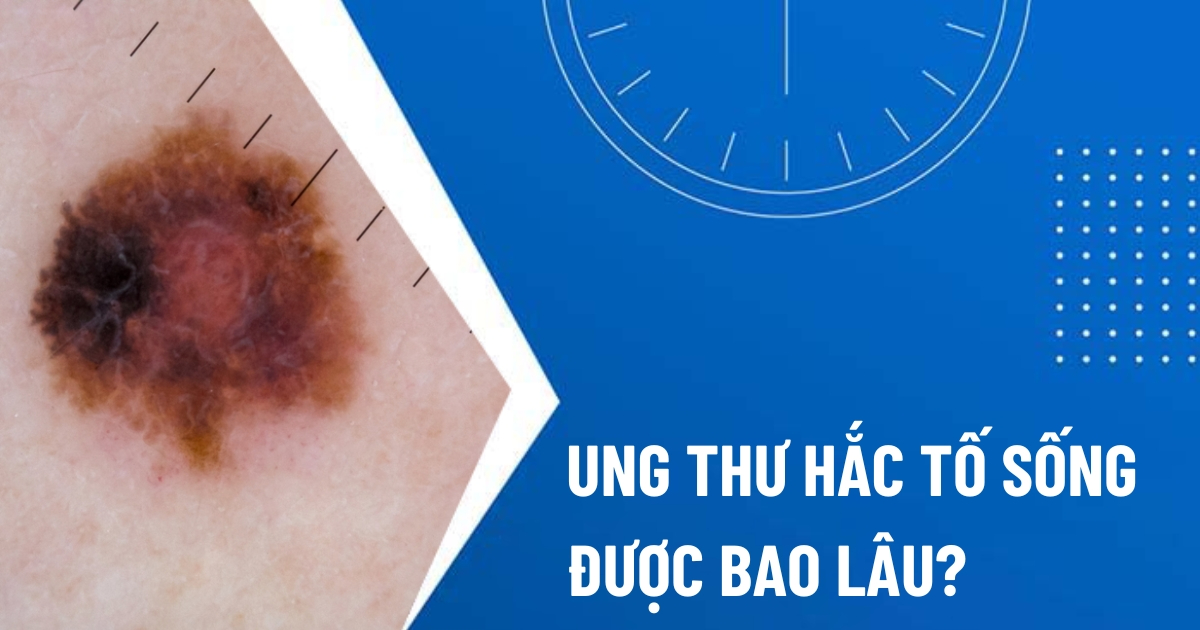 ung thư hắc tố sống được bao lâu