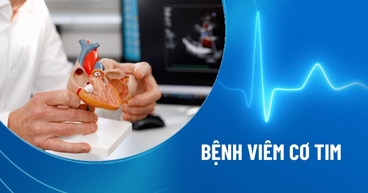 viêm cơ tim
