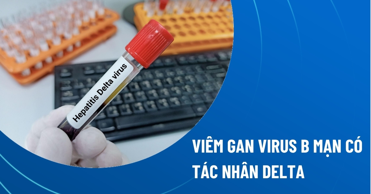 viêm gan virus b mạn có tác nhân delta