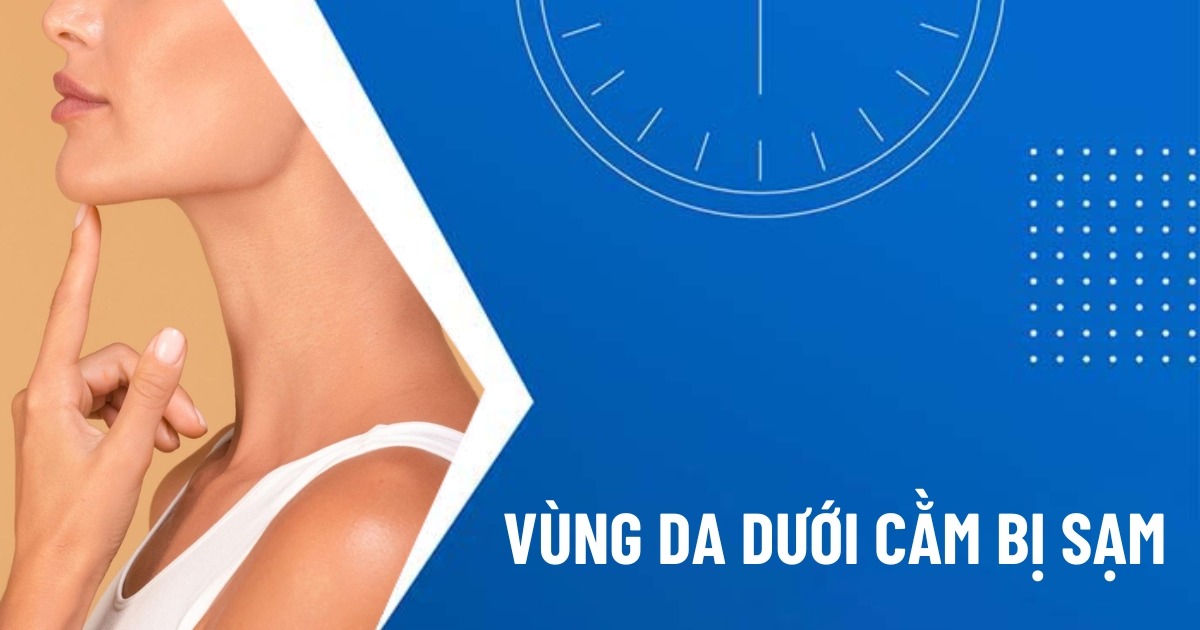 vùng da dưới cằm bị sạm