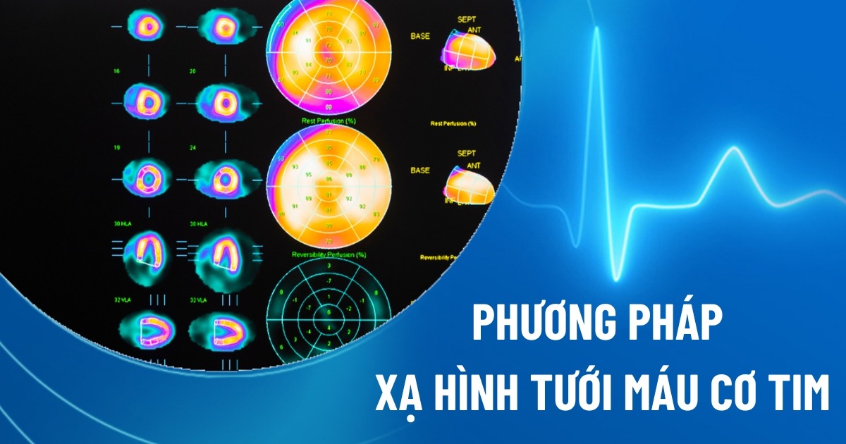 xạ hình tưới máu cơ tim