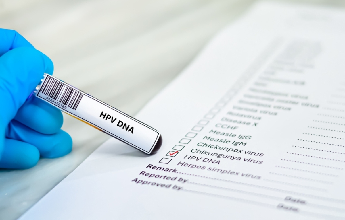 xét nghiệm hpv dna